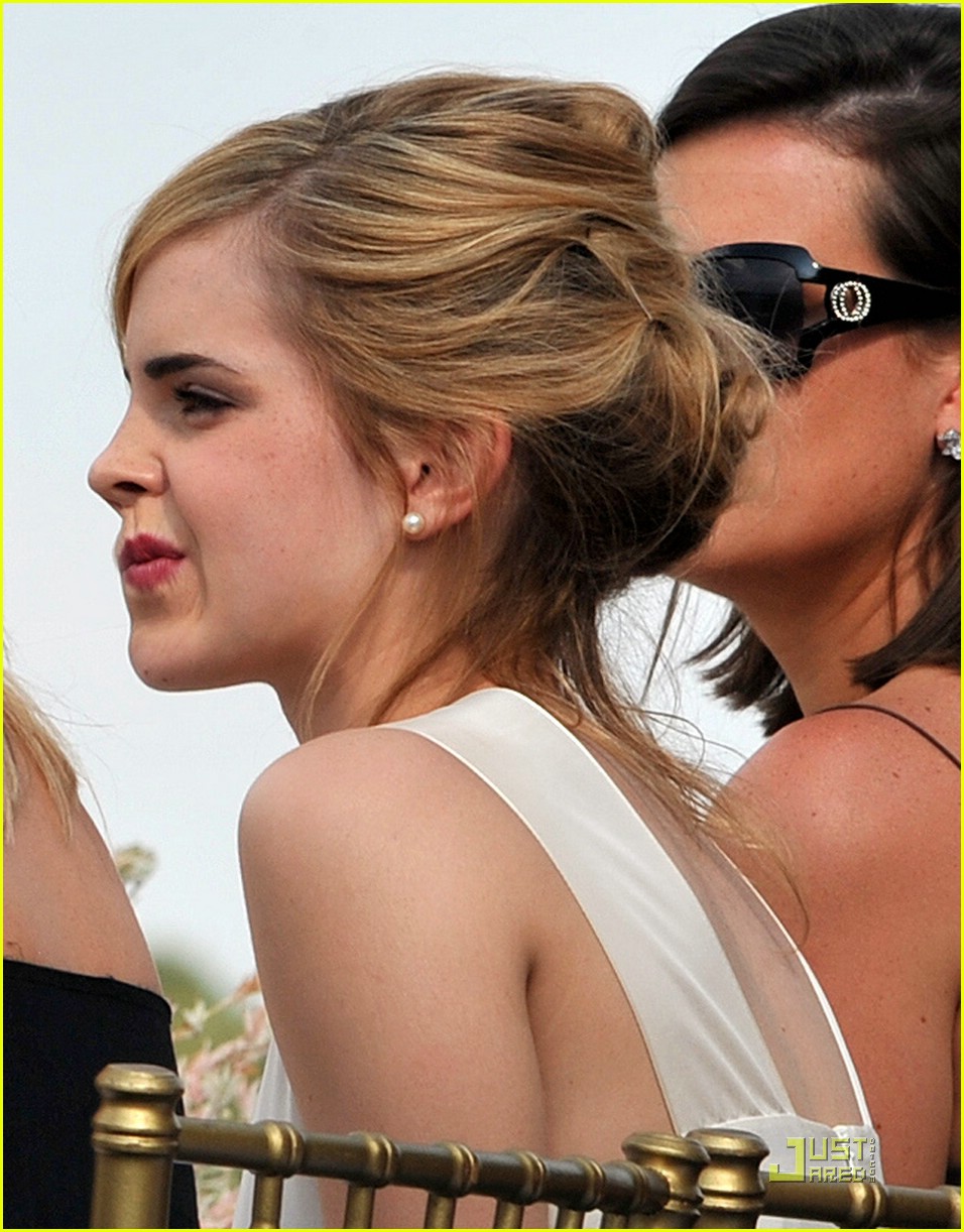 Emma Watson Has Lipstick Teeth Photo 1299651 Photos Just Jared