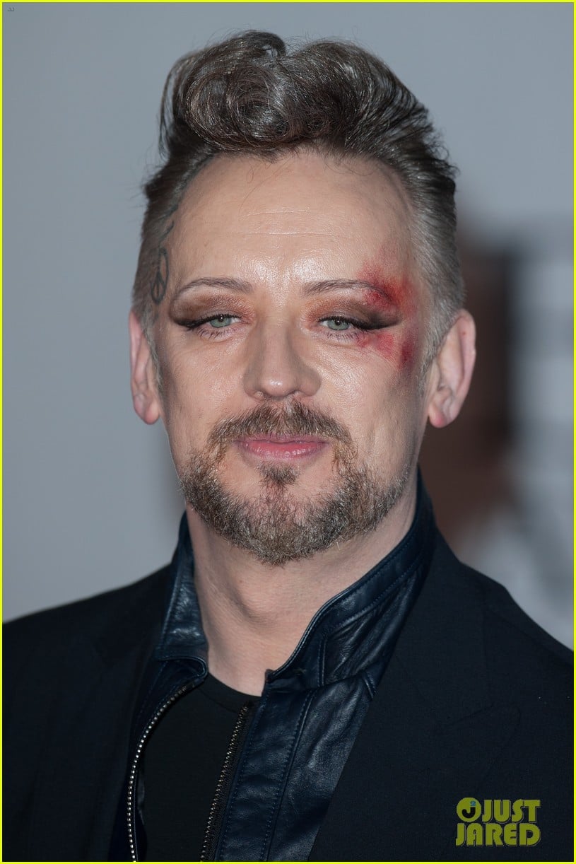 Boy Attends BRIT Awards with Bruised & Bloodied Eye Photo