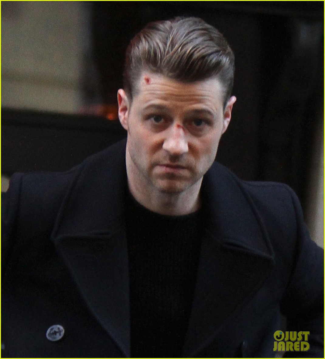Ben McKenzie Sports Bloody Face During 'Gotham' Filming benjamin mckenzie...