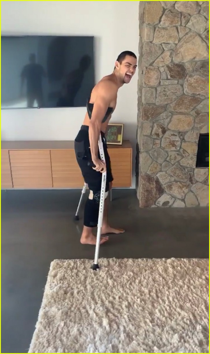 Noah Centineo Shows How He Showers After Undergoing Knee Replacement