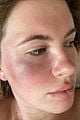ireland baldwin attacked and robbed 02