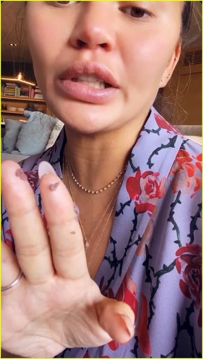 Chrissy Teigen Says Her 'Tongue Is Falling Off' from Eating 'So Much