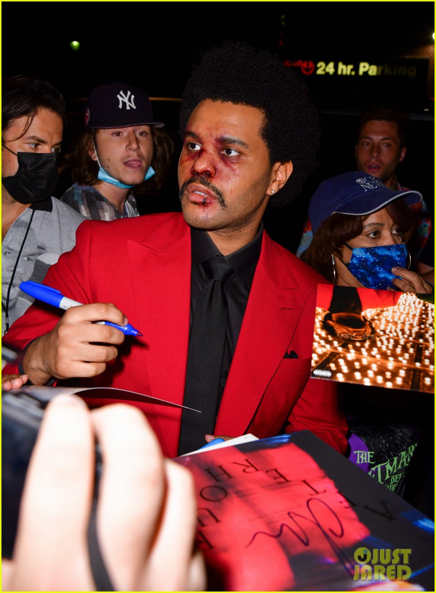the weeknd bruised face for vmas 024478038