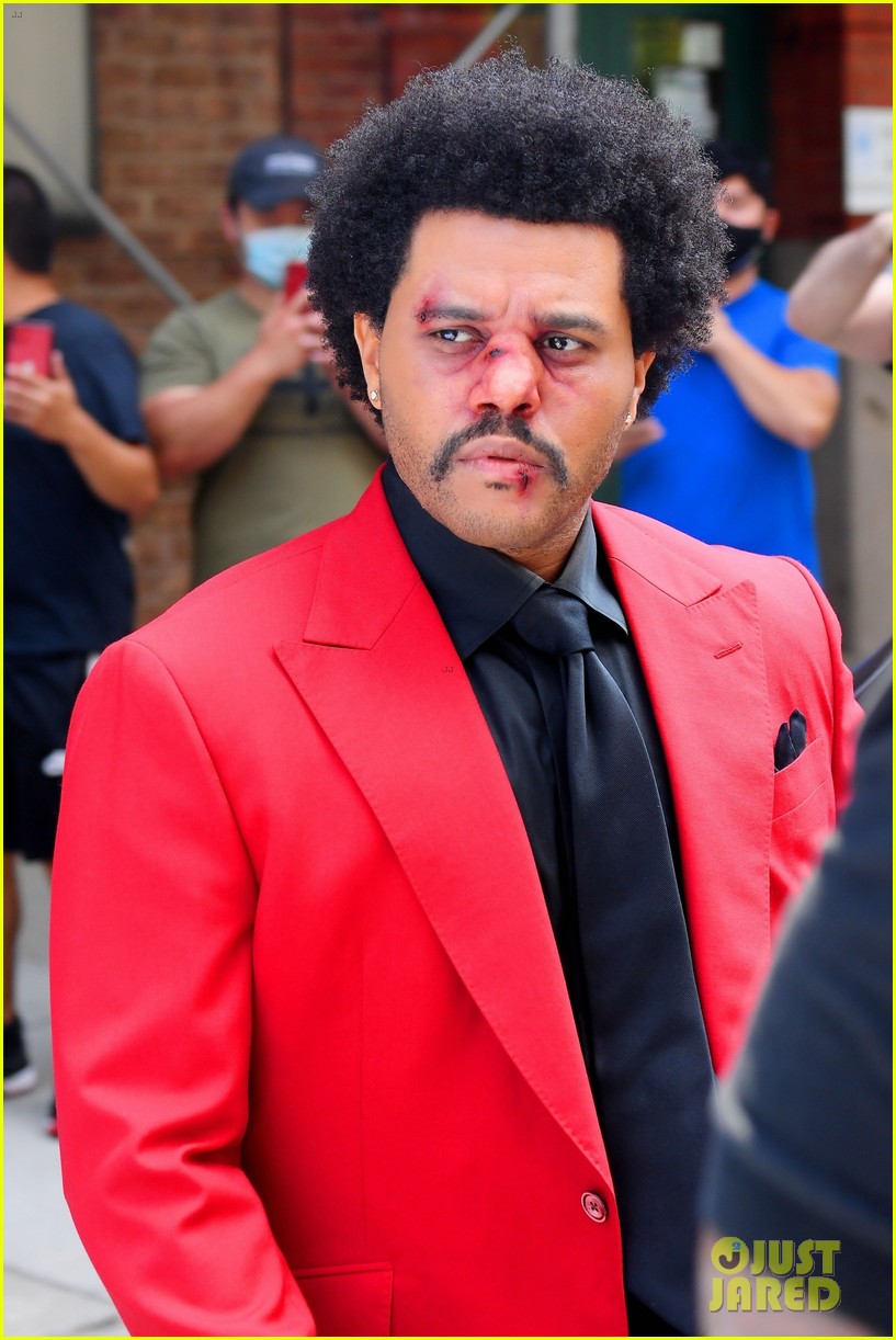 the weeknd bruised face for vmas 054478041