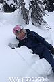 chelsea handler ski injury 01
