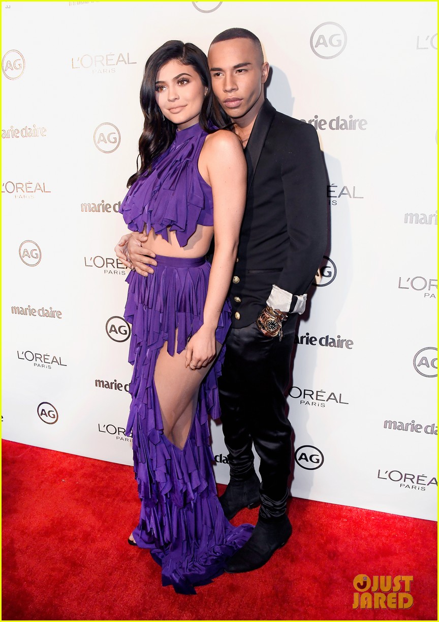 Balmain Designer Olivier Rousteing Reveals Injuries After Being Severely Burned in Fireplace