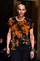 olivier rousteing severely injured in fireplace explosion 11