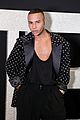 olivier rousteing severely injured in fireplace explosion 14