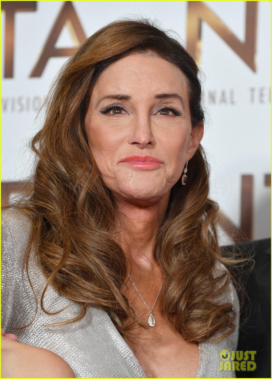 Caitlyn Jenner Gets a Surgery She Was Putting Off for 25 Years: Photo