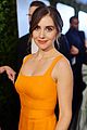 alison brie childhood accident 02