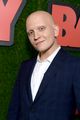 anthony carrigan told to quit acting over alopecia 02