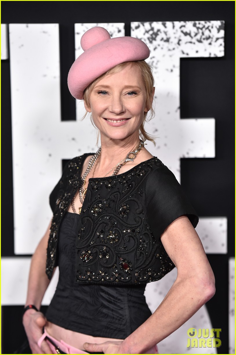 anne heche burned intubated after car crash 034798971