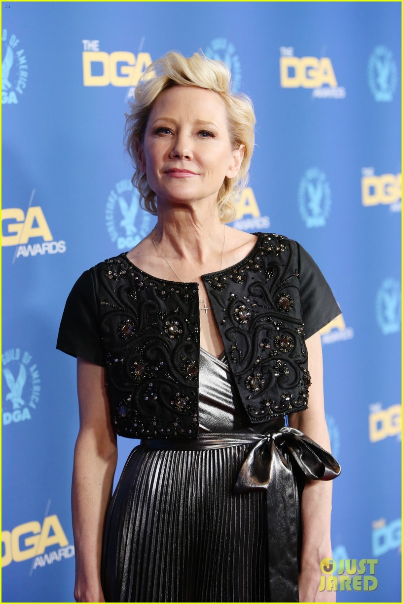 anne heche burned intubated after car crash 054798973
