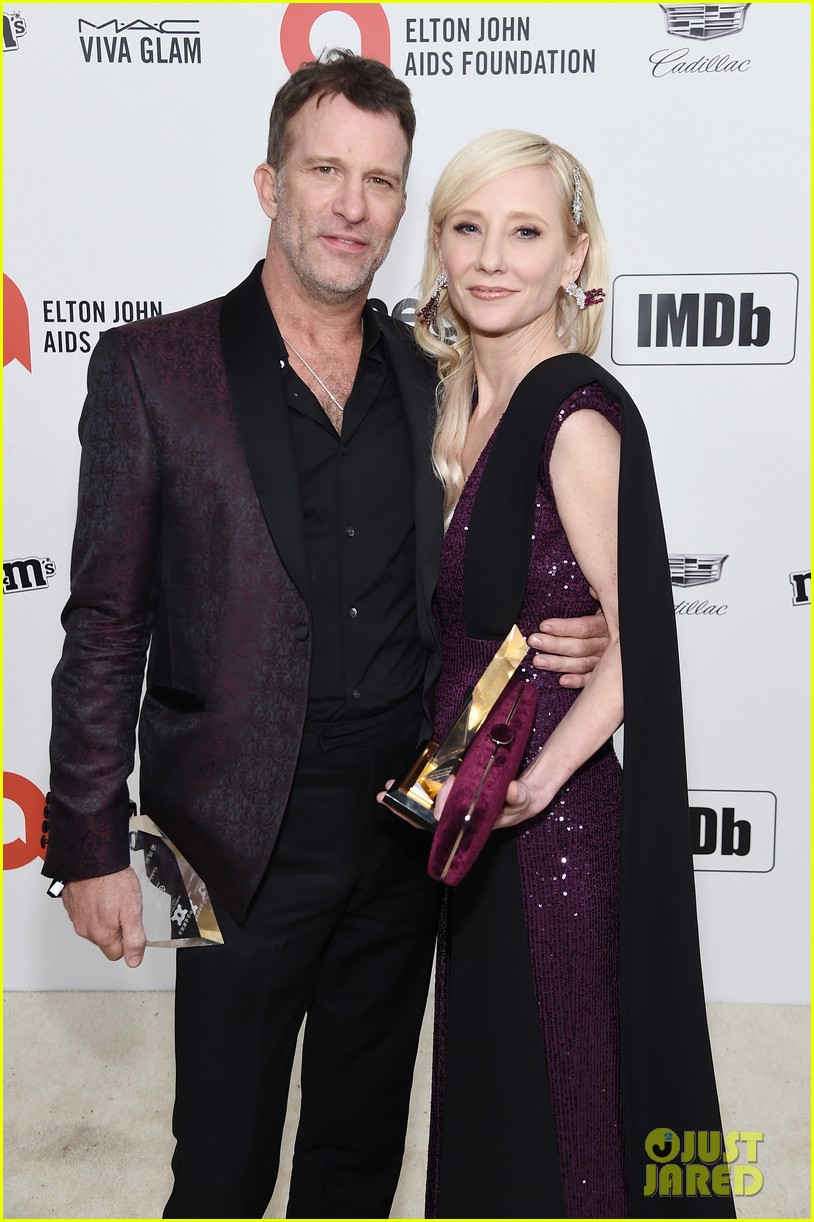 Anne Heche's Exes James Tupper & Thomas Jane Speak Out After Her Car