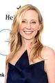 anne heche taken off life support 04