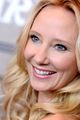 anne heche taken off life support 08