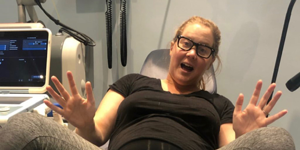 Pregnant Amy Schumer Shows Off Her Latest Ultrasound! Amy Schumer(02)
