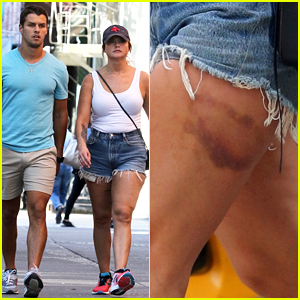 Miranda Lambert Sports Massive Leg Bruise on Stroll with Brendan McLoughlin