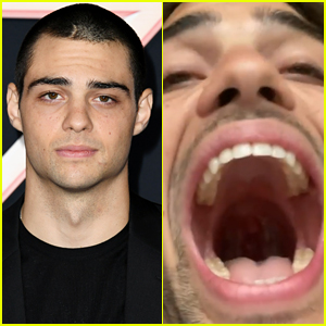 Noah Centineo Reveals He Had Tonsils Removed