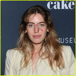 Ewan McGregor's Daughter Clara Walks the Red Carpet With Dog Bite Wounds on Her Face