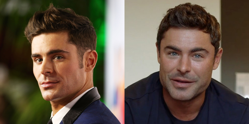 Zac Efron Reacts to Plastic Surgery Rumor Explains What Happened to 