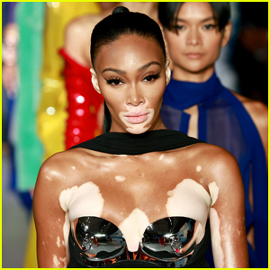 Winnie Harlow Reveals the Real Story Behind How She Came Up With Her Name & Explains Why She Required Medical Care After a Photo Shoot