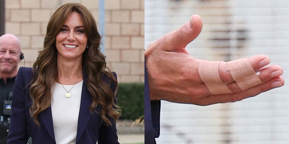 Here's How Princess Catherine Injured Her Fingers After Fans Notice Bandages During Royal Visit | Kate Middleton | Just Jared: Celebrity Gossip and Breaking Entertainment News - Vimarsana News