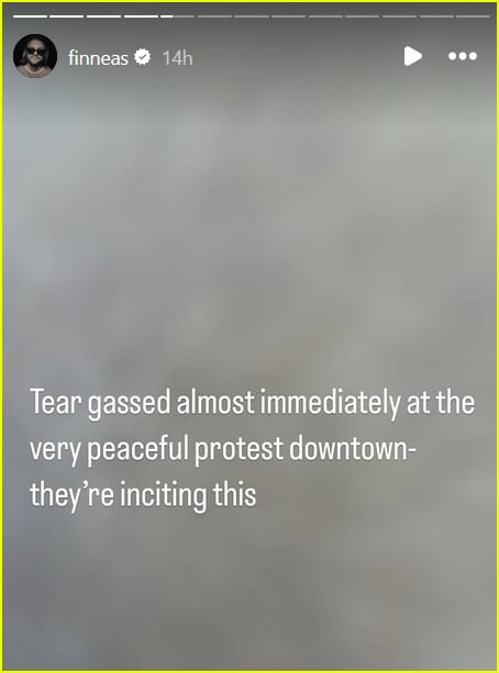 Finneas instagram story