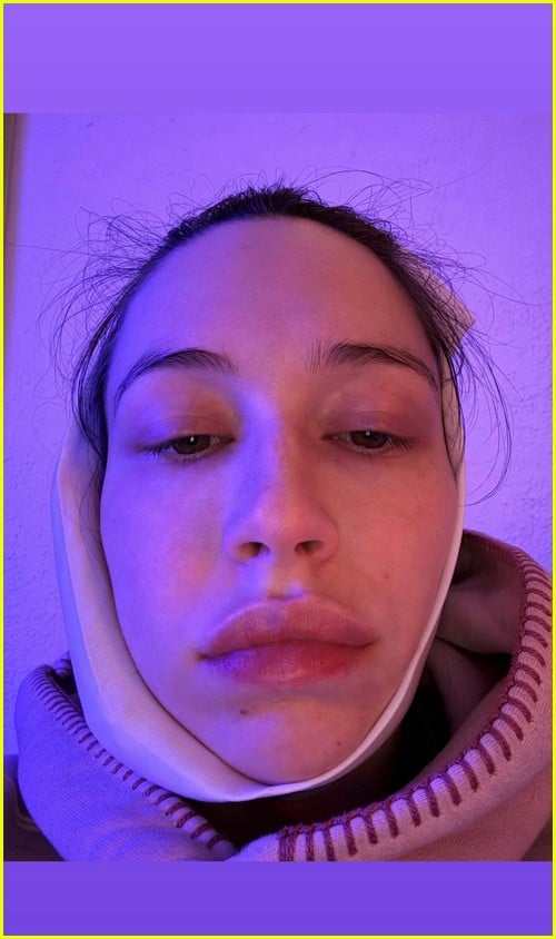 Elsie Hewitt dente do siso