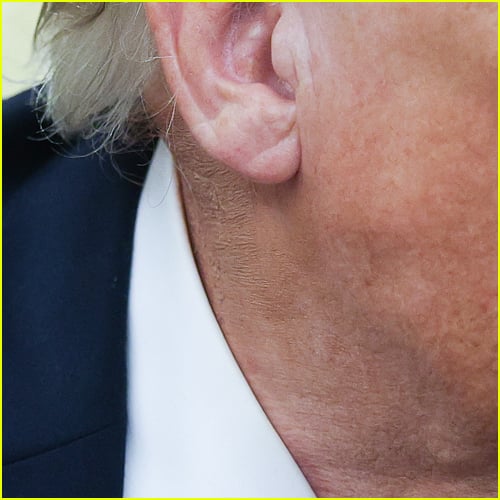 zoomed in look at Donald Trump's neck