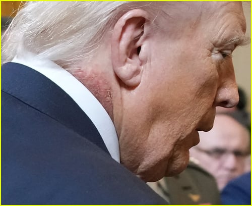 Donald Trump's neck