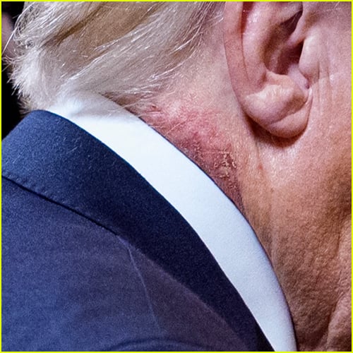 Olhe atentamente para o pescoço de Donald Trump